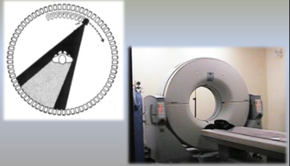 TAC - Equipos de cuarta generación