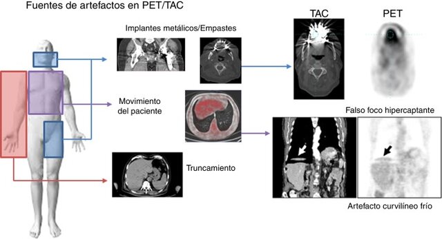 PET - PET/CT