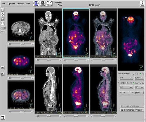 PET - Pisani y colaboradores