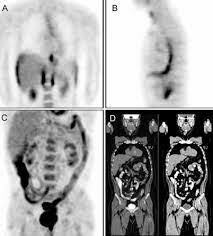 PET - Townsend y Cherry