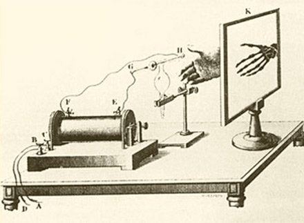 RAYOS X: Máquina de Roentgen - México