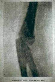 RAYOS X: Primer estudio en Hospital