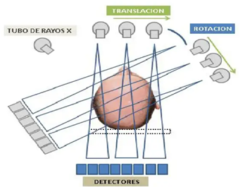 TCP: Segunda Generación