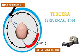 TCP: Tercera Generación