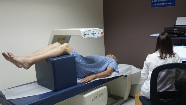 DENSITOMETRÍA ÓSEA: Comercio de la densitometría fotónica dual