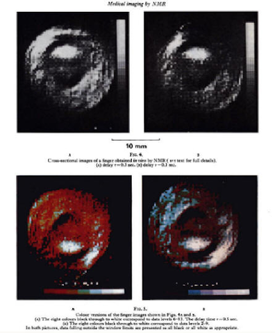 RESONANCIA MAGNÉTICA: Primera imagen