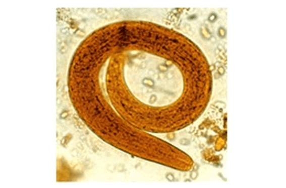 Strongyloides stercoralis