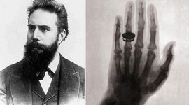 Timeline: Línea del tiempo Radiología de Vanessa