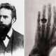 Storia della medicina wilhelm roentgen