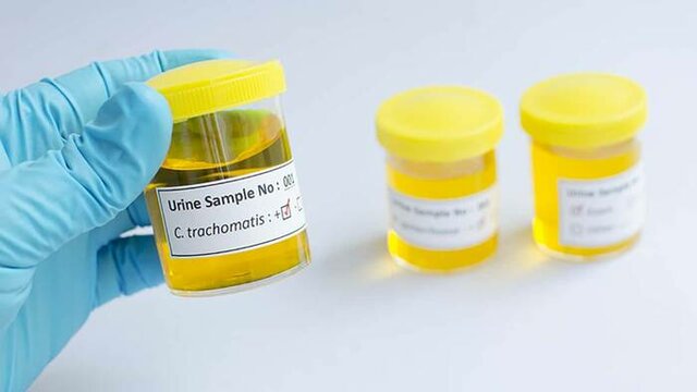 Mexico elimina el tracoma