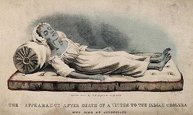 El descobriment de la causa de la còlera