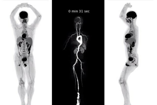 Fue creada escáner de todo el cuerpo