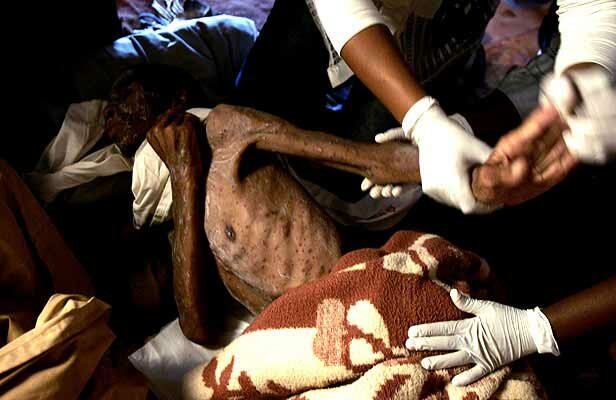 Enfermedad sobre el SIDA