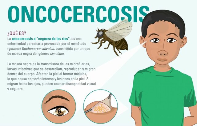 Lanzamiento del Programa de Lucha contra la Oncocercosis