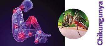 Programa de vigilancia en México