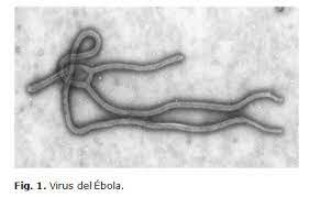 Revisión de erupción de Ebola en Zaire