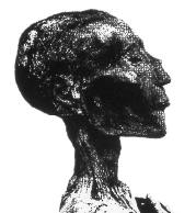 Ramsés V muere de viruela