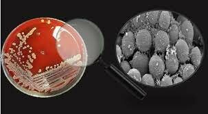 Tres áreas del conocimiento se desarrollaron vertiginosamente; estas eran la patología, la microbiología (término que utilizó Pasteur), la bacteriología (término germano) y la inmunología.