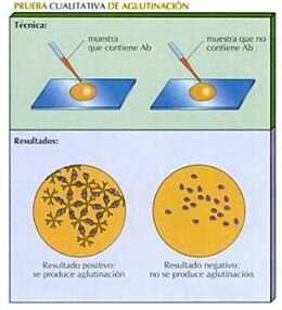 se descubre la aglutinación bacteriana