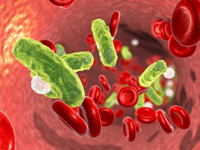 Septicemia