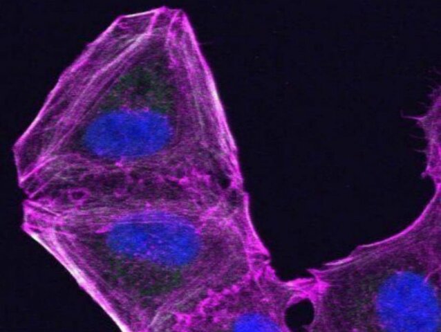 Stephen Page - Origen de las metástasis