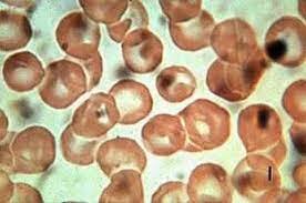 Rayer y Davaine observan en la sangre de un cordero, pequeños cuerpos filiformes que tenían doble longitud de los glóbulos rojos