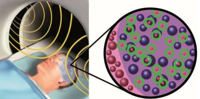 Bases celulares y moleculares de la Hipertermia