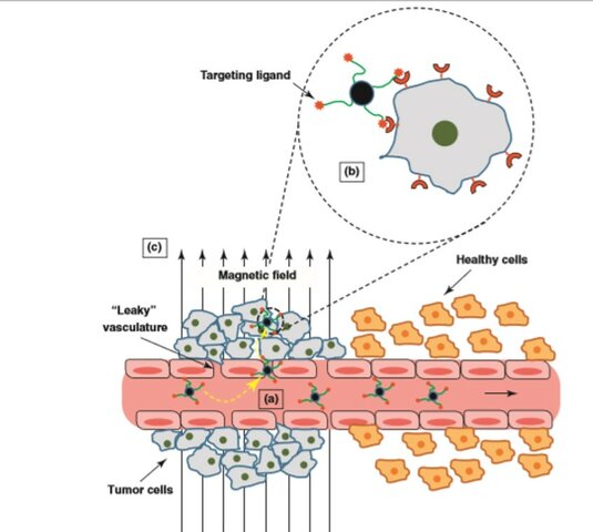El auge de las nanopartículas magnéticas dirigidas en el tratamiento de cáncer
