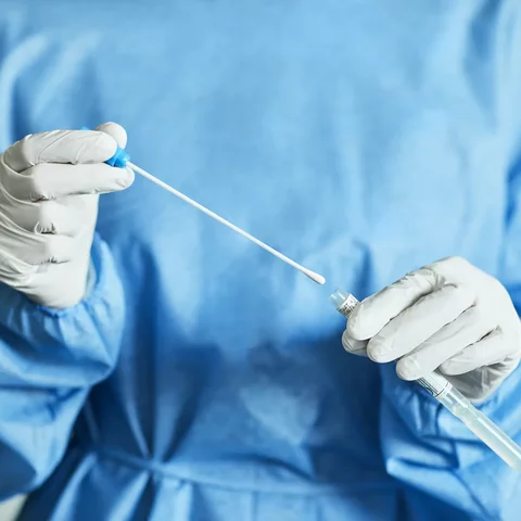 Reacción en Cadena de la Polimerasa: PCR