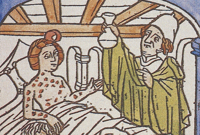 The Columbian Exchange