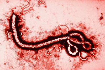 Primera identificación del virus del Ebola
