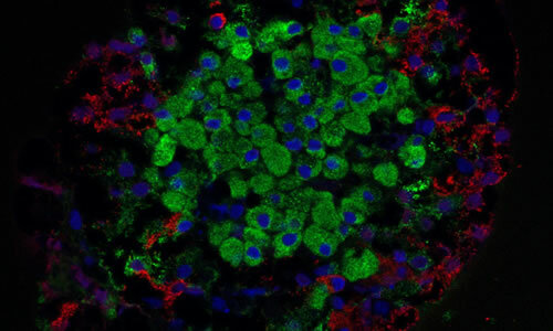 Curar la diabetes mediante células madre nunca ha estado tan cerca