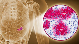 Timeline: “Evaluación in vitro de terapia antitumoral adyuvante:Hipertermia magnética en células fluorescentes de cáncer de mama”