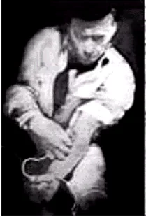 Primer radiografía de tórax con catéter