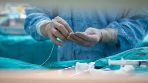 PRIMERA ANGIOPLASTIA CORONARIA EXITOSA