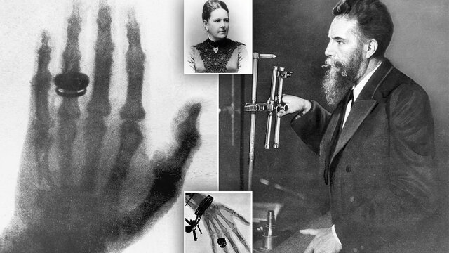 ROENTGEN, Rayos x.