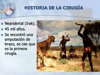 HOMBRE DE NEANDERTHAL