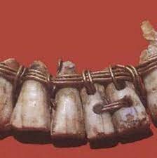 EL PRIMER BIOMATERIAL1920 d. C.