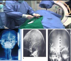 Estudios: Diagnósticos y Terapéuticos