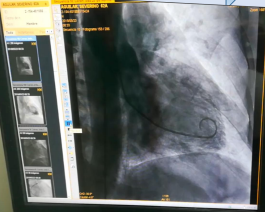 Nuevo equipo de Hemodinámica