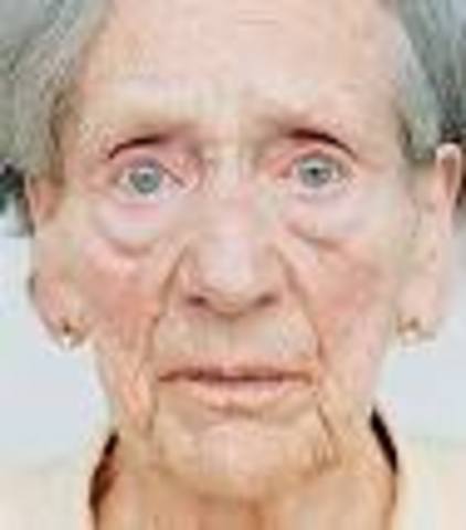 Problemas cognitivos adulto mayor