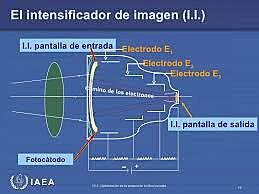 HISTORIA DEL RAYOS X ( INTENSIFICADOR DE IMAGEN)