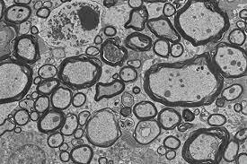 Se inventa el Microscopio de electrones
