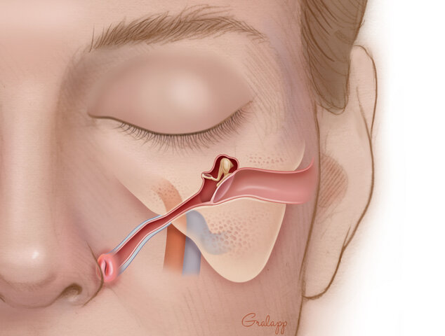 Bartolommeo Eustachio