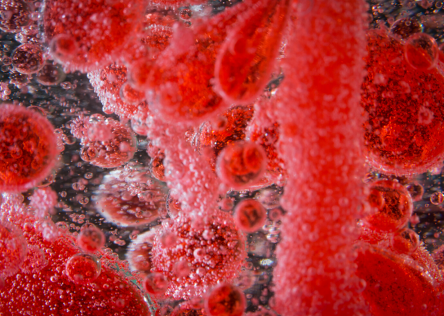 Acute stroke intervention