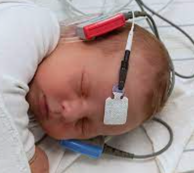 Universal Newborn Hearing Screening