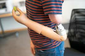 Face and limb transplant