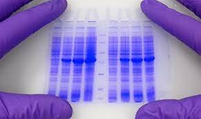 Electroforesis en gel
