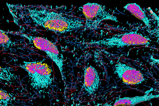Descubrimiento de las células HeLa