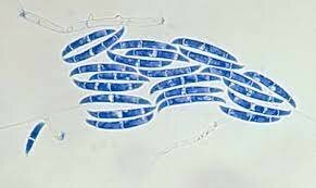 Orton diferenció entre los fenómenos de resistencia y escape a las enfermedades (1909)